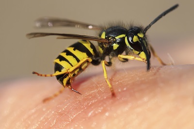 Bee Stings